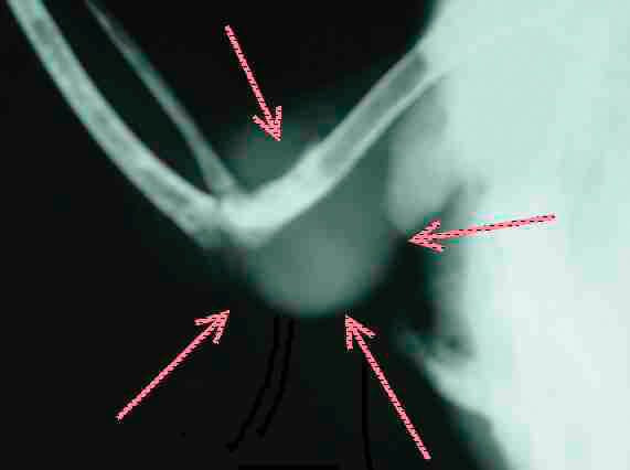 Cancer in pet birds
